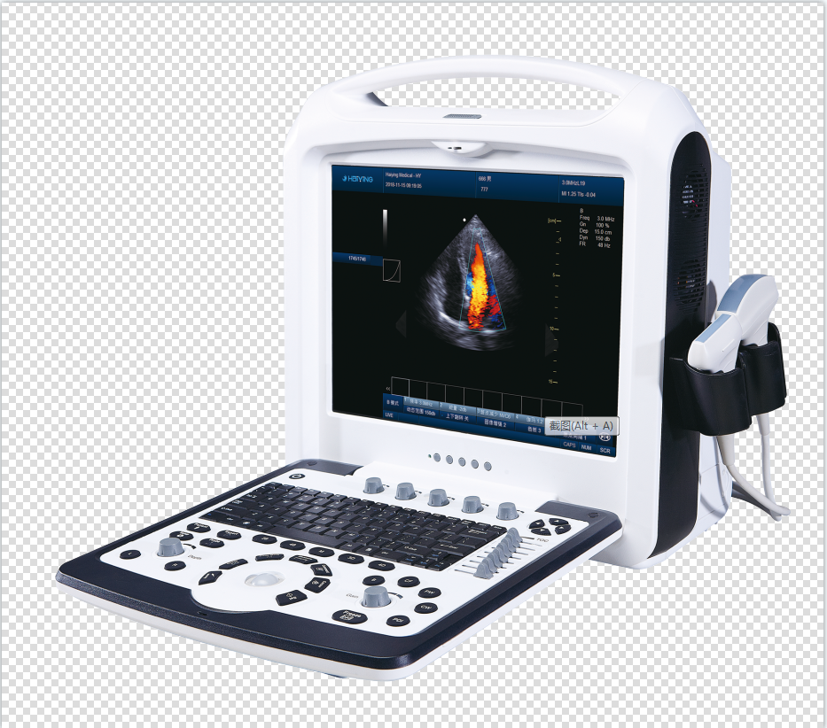 便攜式彩色多普勒超聲診斷儀