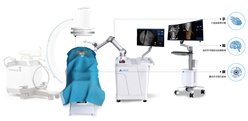 “智微天眼”骨科手術(shù)機(jī)器人